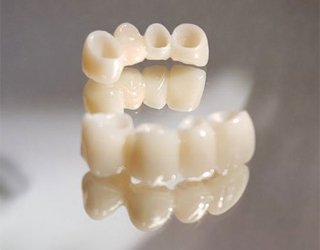 Безметалловая керамика зубов